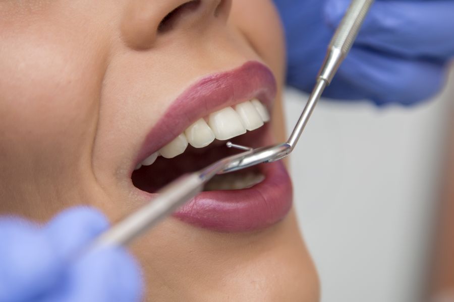 na czym polega leczenie kanałowe zębów