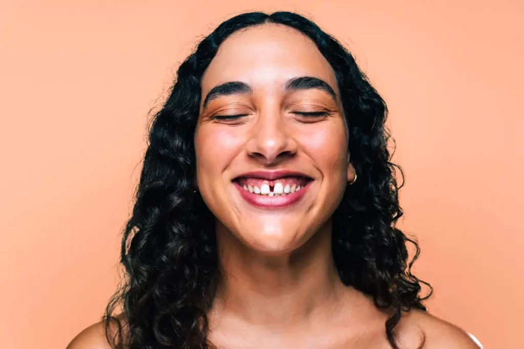 Diastema – czym jest